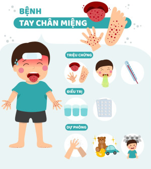 Xã An Phước - Tăng cường phòng, chống bệnh Tay – chân – miệng trong cộng đồng